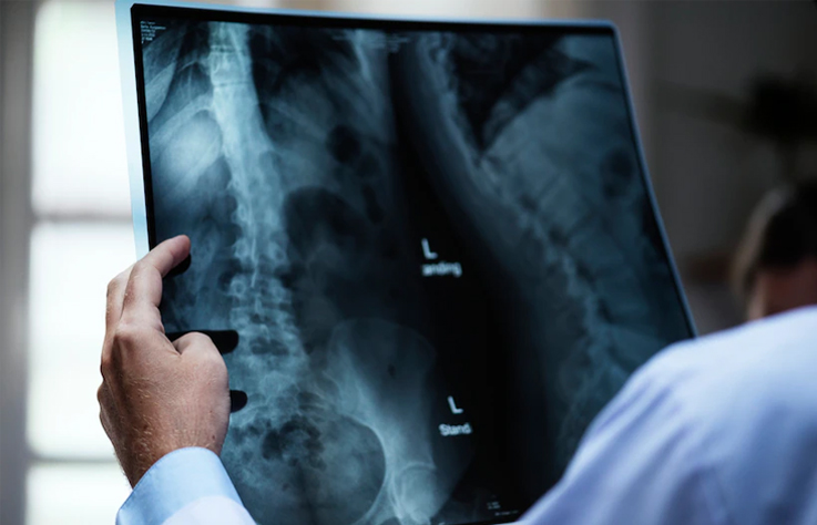 radiografia-1
